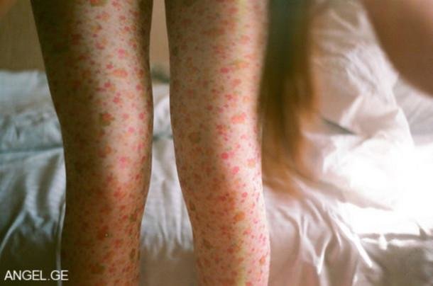 Zdroj: patternity.org